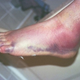 Illustration for article titled There Are So Many Ways To Make Your Leg Turn Purple